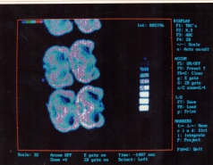 Detectors picture no. 34
