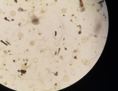 Eilat sample collection 2022 picture no. 19