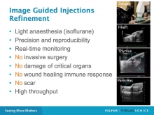 Guided Injections
